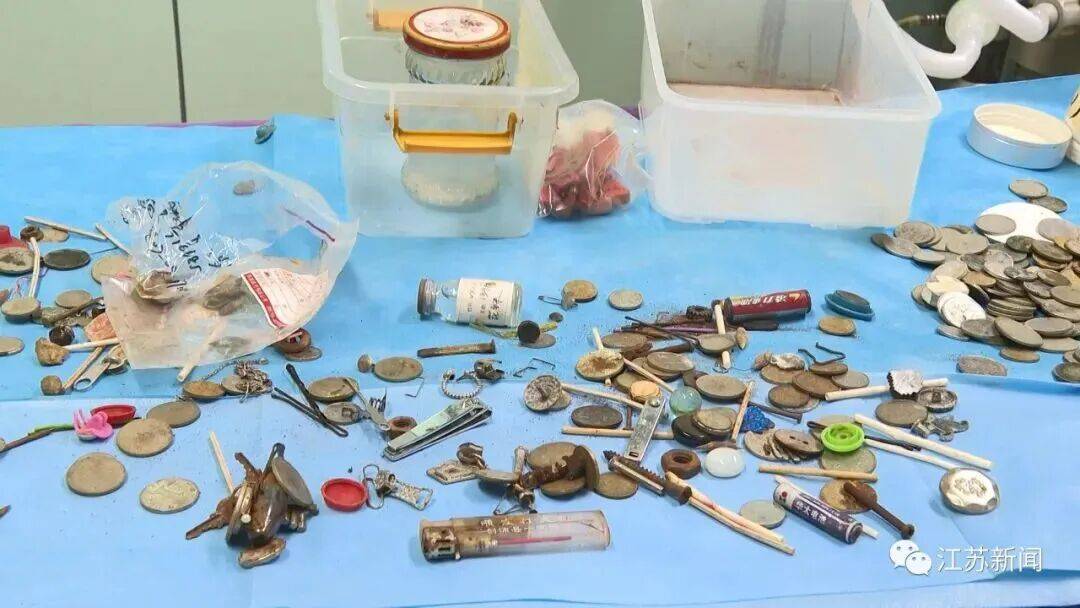 浙江男子12岁误吞水银温度计，32岁腹痛就医时才取出！男子：当时因害怕不敢告知家长